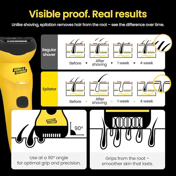 Gorilla Technique Epilator 3000V, Facial & Body Hair Removal Device, Pain Relief Roller, Cordless Rechargeable Electric Tweezers for Women & Men, Triple Tweezers, 8000RPM, Korean Skin Care - 3000V-Velvo Beauty