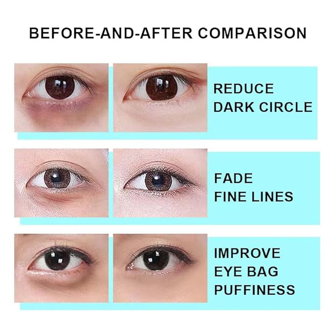 Snail Peptide Eye Cream, Snail Mucin Eye Cream Contains Niacinamide, Hyaluronic Acid To Reduce Wrinkles, Dark Circles, Puffiness and Fine Lines 17 ML-Velvo Beauty