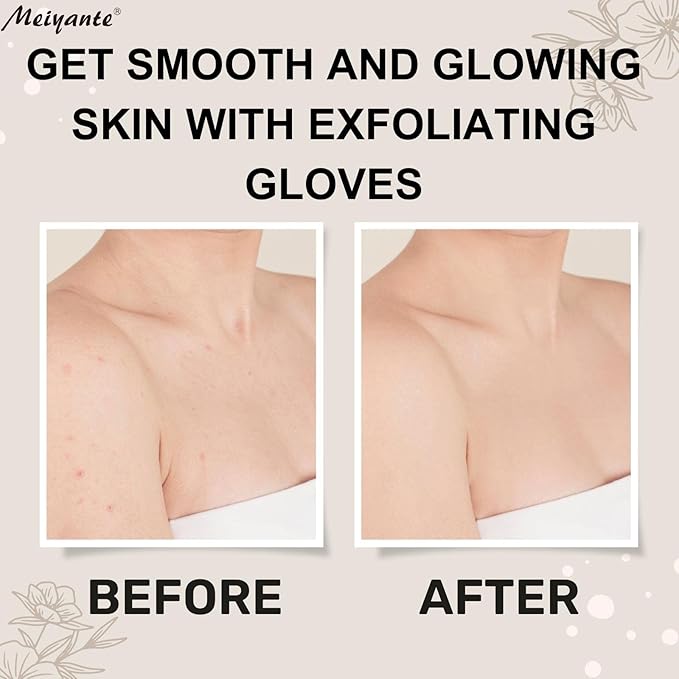 Exfoliating Glove - Body Scrub for Smooth and Soft Skin - Body Exfoliator for Ingrown Hair Dead Skin Remover and Itchy and Flaky Skin - Scrubber Shower Accessories 1 Pair Glove Mens Stocking Stuffer-Velvo Beauty