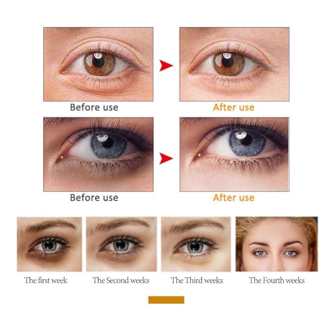 Peptide Under Eye Roller Serum With Roller Balls For Dark Circles And Puffiness | Massage Ball Cream for Fine Lines and Wrinkles | Hydrates Brightens Under Eye Area Restores Skin Firmness (PEPTIDE)-Velvo Beauty