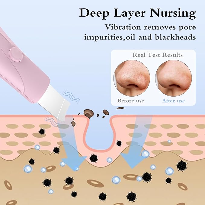 Skin Scrubber Face Spatula Skin Spatula Pore Cleaner Blackhead Remover Tools for Facial Deep Cleansing Skin Care Tool for Men and Women (Pink)-Velvo Beauty