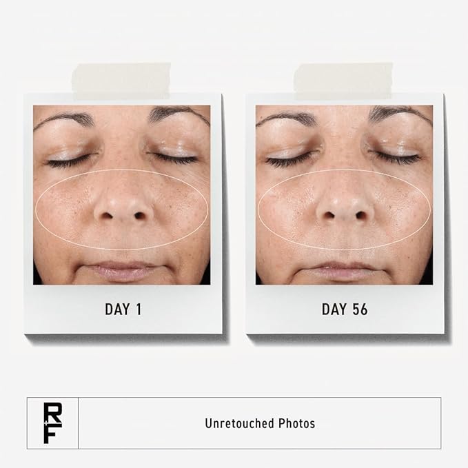 Rodan + Fields Active Hydration Serum | 1oz | Boosts Hydration Levels | Glycerin | Hylauronic Acid-Velvo Beauty