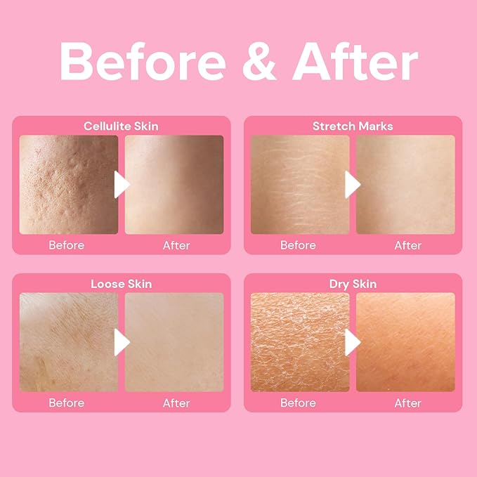Enaskin Naturals Anti Cellulite Cream: Skin Firming and Tightening Lotion for Booty, Legs & Belly - Lifting Body Mask for Women Loose Skin, Lift & Firm Moisturizing Bum Bum Care-Velvo Beauty