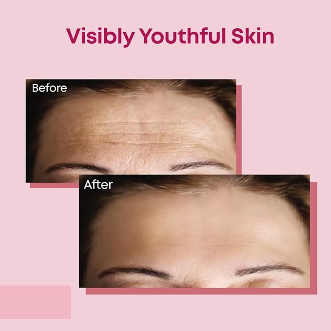 Forehead Wrinkle Patches | Anti-Wrinkle Facial Patches for Fine Lines | Overnight Wrinkle Filler & Deep Line Treatment | Disposable Face Tape for a Youthful, Firmer, and Smoother Appearance | 20 Count-Velvo Beauty