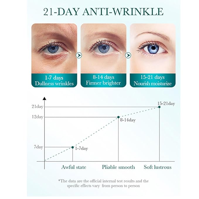 2 PCS Hyaluronic Acid Repair Eye Cream for Dark Circles,Bags Under and Puffiness,Eye Wrinkle Firming Cream Moisturise Repairing Thghten Eye Skin Care-Velvo Beauty