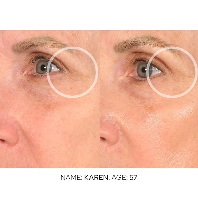 SiO Cooling Cryo Eye Cream - Anti-Aging, Hydrating Under Eye Concentrate Formulated For Targeting Dark Circles, Fine Line, Wrinkles, Puffiness & Bags-Velvo Beauty