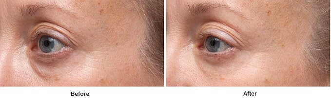 Dr. Dennis Gross Ferulic + Retinol Triple Correction Eye Serum: for Wrinkles, Loss of Elasticity, and Rough Texture, 0.5 fl oz-Velvo Beauty