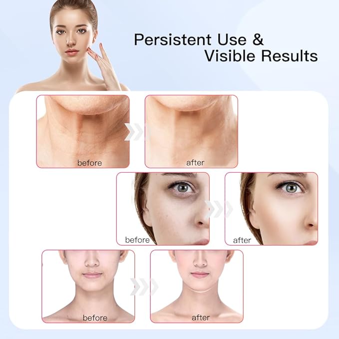 Neck Face Massager, Multifunctional Facial Massager, Face Sculpting Tool for Skin Care with Vibration, Thermal (Black Gold)-Velvo Beauty