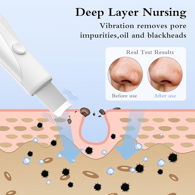 Skin Scrubber Face Spatula Skin Spatula Pore Cleaner Blackhead Remover Tools for Facial Deep Cleansing Skin Care Tool for Men and Women (White)-Velvo Beauty