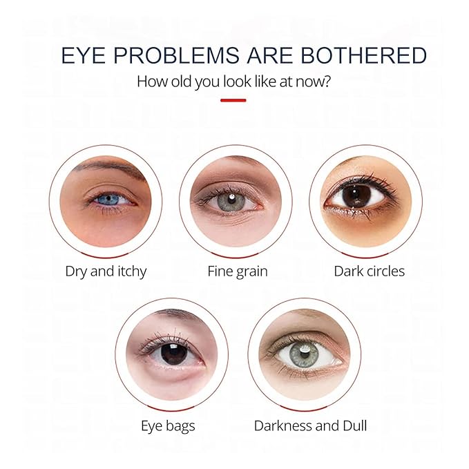 Open eyes awaken peptide lifting eye gel,peptide eye lifting gel,Reduces Dark Circles, Dark circles Hydrating firming Eye cream (5PCS)-Velvo Beauty