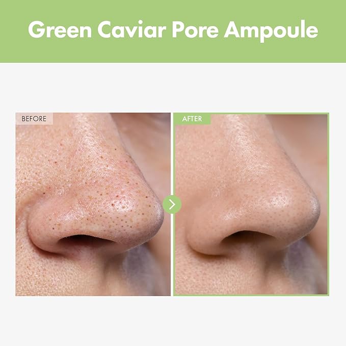 Green Caviar Pore Ampoule With 2,500ppm Green Caviar, Niacinamide, Pore Minimizer, Hydrating, Firming, Pore Tightening, Reduces Pores, Korean Skin Care, 33ml, 1.11 fl.oz.-Velvo Beauty