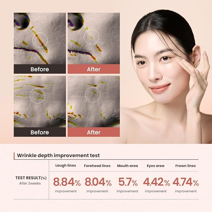 Lifting Serum – 30ml (1.01 fl oz) – Visibly Firms Skin, Reduces Wrinkles, Tightens Pores, Deep Hydration with Peptides & Caffeine-Velvo Beauty