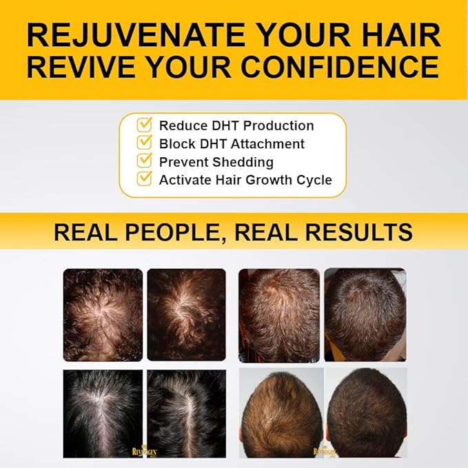 Revivogen MD Scalp Therapy Thinning Hair Solution, Shampoo & Conditioner Set-Velvo Beauty