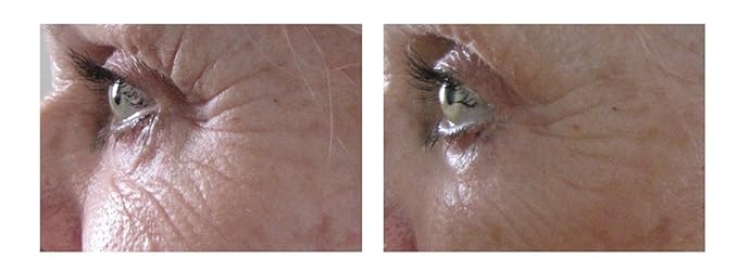 Airelle Age-Defying Eye and Lip Treatment | Anti Aging, Helps Reduce Wrinkles, Fine Lines | Dermatologist Recommended | Hyaluronic Acid, Berrimatrix | Natural Ingredients | .3 Fl Oz-Velvo Beauty