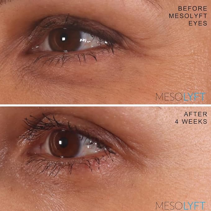 Power Combo Neck & eye Roller Brightening Face Serums for Anti-Aging Get Lip Pump's best Lip Plumper an Effectively Aging Skin Serum Multi-purpose, Eyes Neck & Décolleté Beauty Serum-Velvo Beauty