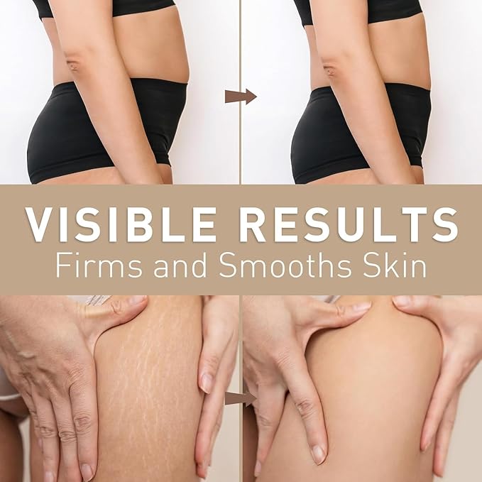 Belly Firming Cream for Tightening & Cellulite – Skin Firming Cream for Stomach, Thighs & Butt – Moisturizing & Lifting Body Lotion for Women-Velvo Beauty