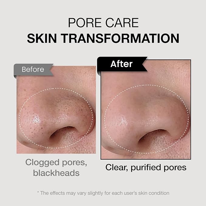 coxir TXA MUCIN ALL-IN-1 PORE MASK –Gelato Texture Wash-Off treatment | Ampoule Mask-to-Foam | Charcoal+ Snail+TXA | Blackhead Remover |Daily Pore Detox for Oily & Sensitive Skin|4.05fl.oz-Velvo Beauty
