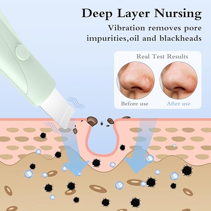 Skin Scrubber Face Spatula Skin Spatula Pore Cleaner Blackhead Remover Tools for Facial Deep Cleansing Skin Care Tool for Men and Women (Green)-Velvo Beauty
