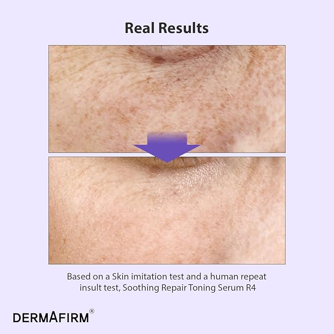 DERMAFIRM Bakuchiol Retinol Serum for Glass Skin with Niacinamide & Peptides | Daily Korean Skin Care for Sensitive Skin | Soothing Repair Toning Serum R4 for Glass Skin-Velvo Beauty