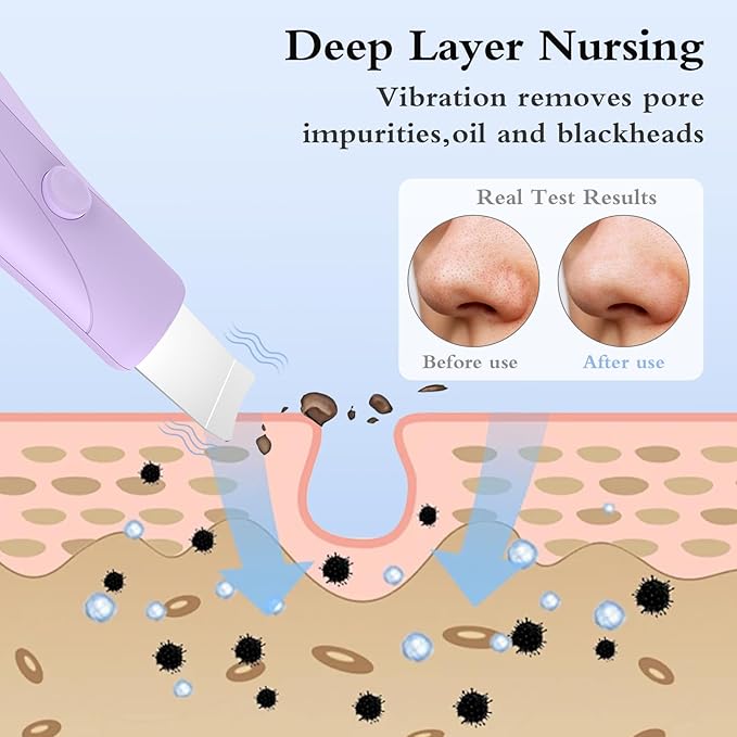 Skin Scrubber Face Spatula Skin Spatula Pore Cleaner Blackhead Remover Tools for Facial Deep Cleansing Skin Care Tool for Men and Women (Purple)-Velvo Beauty