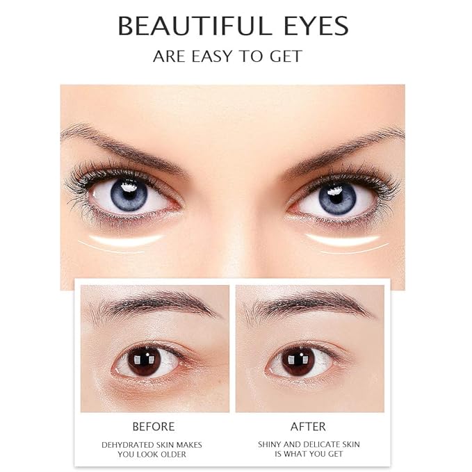 VENZEN Gold Moisturizing Eye Cream Anti Aging Anti Wrinkle Shade Dark Circles Shine Serum Glycerin Delicate Hyaluronic Acid 15g-Velvo Beauty