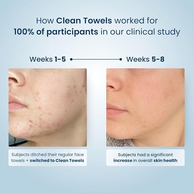 Clean Skin Club Clean Towels XL™, USDA Certified 100% Biobased Dermatologist Approved Face Towel, Disposable Makeup Remover Dry Wipes, Facial Wash (4 pack)-Velvo Beauty