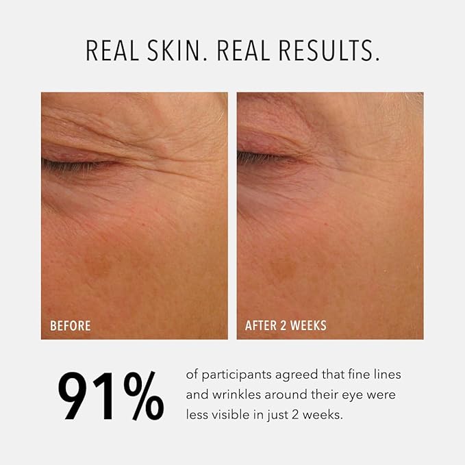 HydroPeptide Eye Authority, Brightens and Helps Restore Radiance to Tired Looking Eyes, 0.5 Ounce-Velvo Beauty