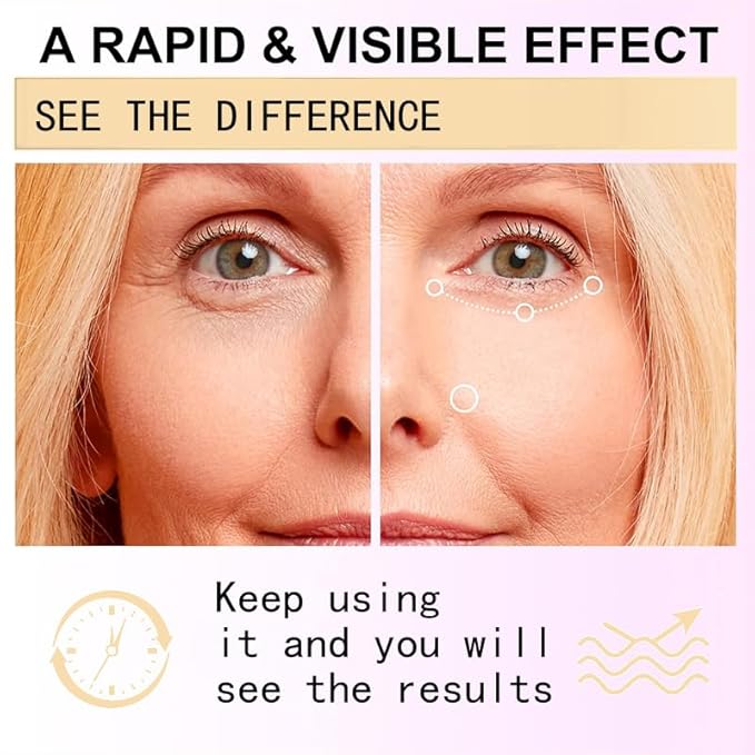 Snail Peptide Eye Cream for Dark Circles, Puffiness and Wrinkle, Snail Mucin & Nicotinamide, Moisturizing, Hydrating, Firming, Massage Ball, 17ml-Velvo Beauty