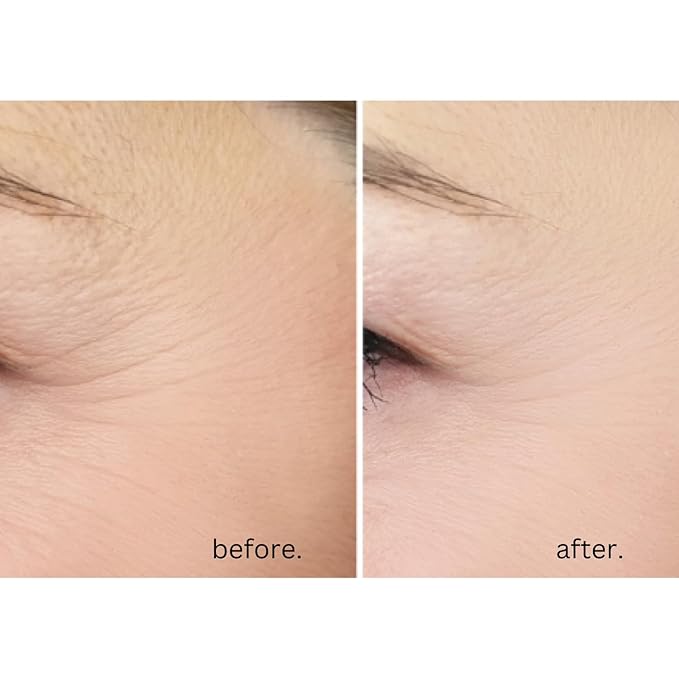 AWARD-WINNING Anti-Age Eye Cream - 5X MORE EFFECTIVE. With 20% Vitamin C & Hyaluronic Acid. Blast away dark circles, eye bags and puffiness - Reduce wrinkles and crow’s feet. Highest strength. 15ml-Velvo Beauty
