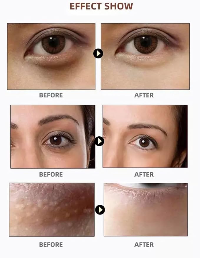 PURABEAUTY Advanced Eye Treatment Mask, Anti-Aging, Reduce Wrinkles and Fine Lines, Under Eye Treatment For Dark Circles, Under eye Mask For Puffiness- 60 PCs-Velvo Beauty