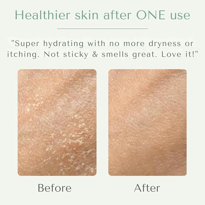 Yobee Body & Face Cream for Dry, Itchy Skin | Dermatologist Formulated | Probiotics, Honey, Turmeric, Vitamins B12 & E, Ceramides, Shea Butter | Fragrance Free | For Kids & Adults | Soothe Eczema-Velvo Beauty