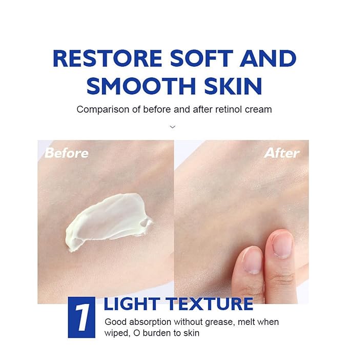 Retinol Cream, Retinol Moisturizer for Face and Neck, Wrinkle Cream for Face, Retinol Complex,Wrinkle Cream Anti Aging Retinol Facial Cream with Hyaluronic Acid, Collagen cream,Anti aging cream.-Velvo Beauty