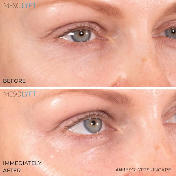 Neck & Eyes Combo Skincare Tool under Eye Serum With Neck Line Remover Neck and Décolletage Beuty Tool & Under Eye Wrinkle Filler Exfoliates the Skin, Visibly Firm & Smooth Necklines-Velvo Beauty