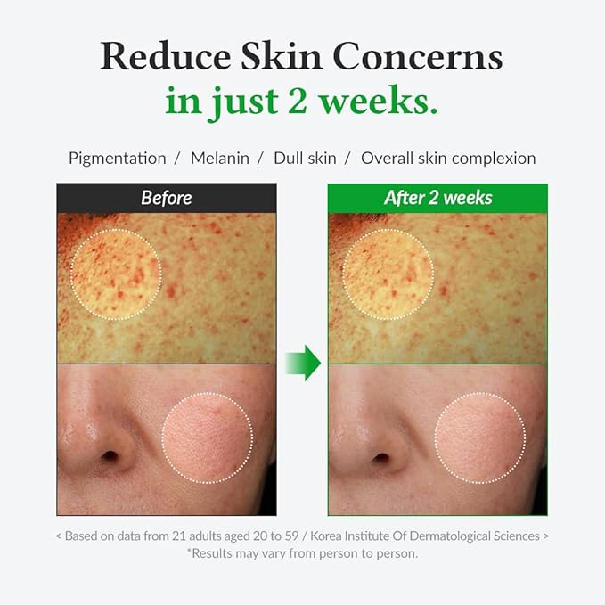 Dr.Althea Gentle Vitamin C Serum | Benefits Skin Tone and Pigmentation | Gentle on Skin For Even Skin Tone | Korean Vegan Skin Care for All Skin Types (Gentle Vitamin C)-Velvo Beauty