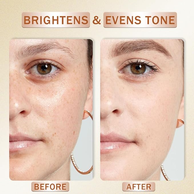 Vitamin C Serum for Face with Hyaluronic Acid, Boost Skin Collagen, Brightening, Antioxidant, Anti-Aging, Hydrate & Plump, Improve Appearance of Dark Spots, Tone, Fine Lines Facial Serum 30ml/1 fl oz-Velvo Beauty