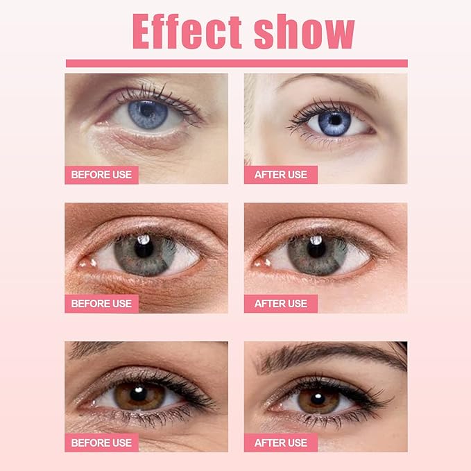 Rosehip Eye Cream Stick, Moisturizing, Hydrating, Lightens Lines and Dark Circles, Lifting, Firming-Velvo Beauty