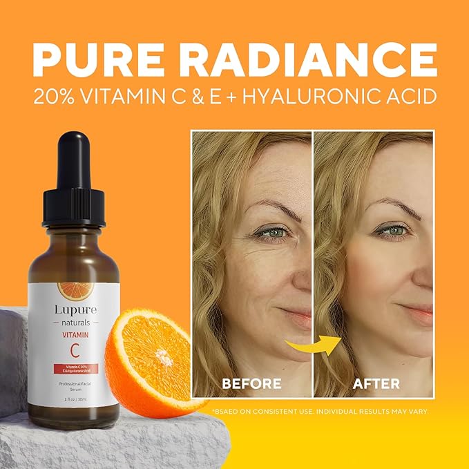 Professional Vitamin C Face Serum 20%, Anti Aging Facial Super Vit C Serum with Ascorbic Acid Hyaluronic Acid & Vitamin E for Dark Spots, Skin Care, Christmas Gift & Stocking | 1 Fl. Oz-Velvo Beauty