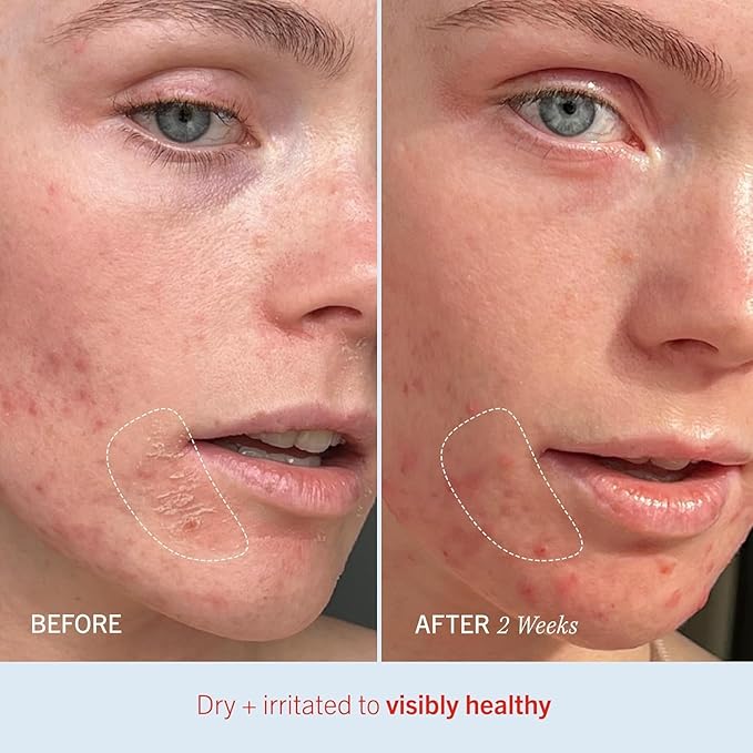 First Aid Beauty - Ultra Repair Cream, Intense Hydration Whipped Colloidal Oatmeal, Clinically Proven to Strengthen Skin Barrier & Help Relieve Eczema, Face & Body Moisturizer, 14 oz Vanilla Cinnamon-Velvo Beauty