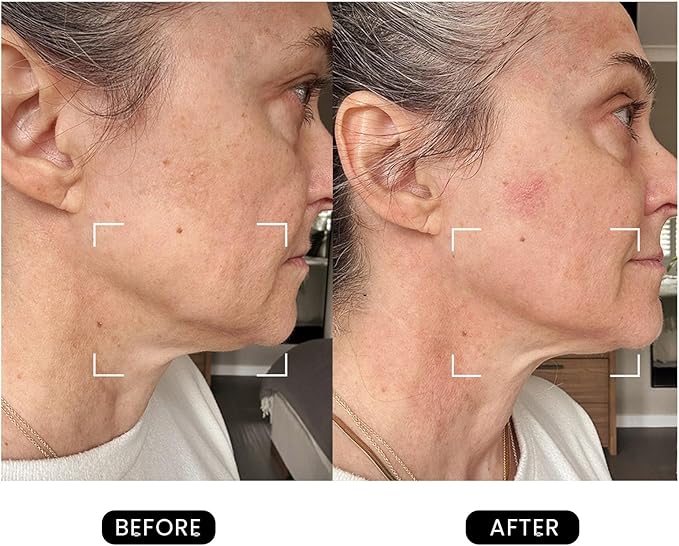 Revive Skincare for Anti-Aging, Glow Like Never Before,Multifunctional Beauty Device, Facial Massager for Home use-Velvo Beauty