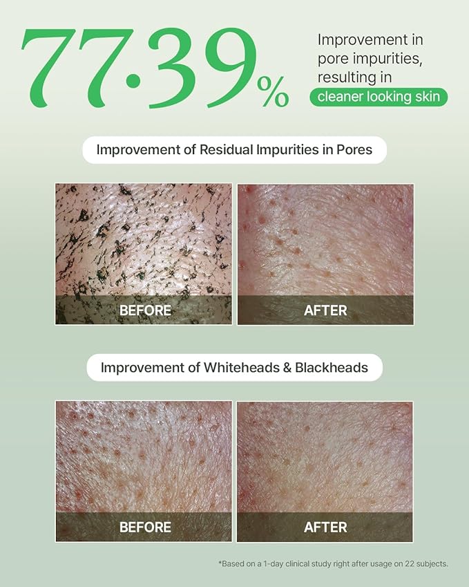 FULLY Green Tomato Pore Detox Clay Mask Cleanser, Pore Minimizing, Blackhead Care, Sebum Control, Exfoliation, Vegan, Face Wash, Sensitive Skin, Korean Skincare 4.05 fl.oz-Velvo Beauty