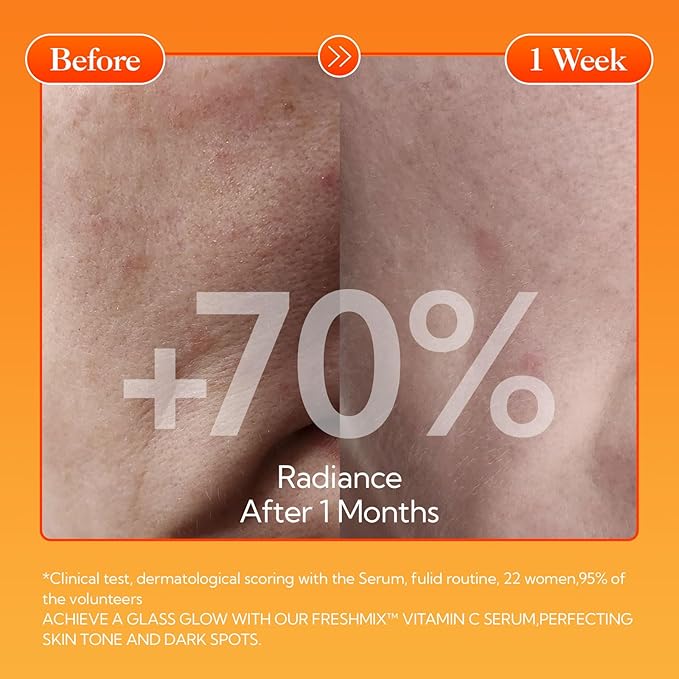 LANBENA Revolutionary Vitamin C Tablets Serum for Face, Illuminating Fcae Serum With Niacinamide, Brightening Anti-Aging Essence for Sensitive Skin, Non-Greasy, Reduces Dark Spots & Wrinkles (1.05 Oz)-Velvo Beauty