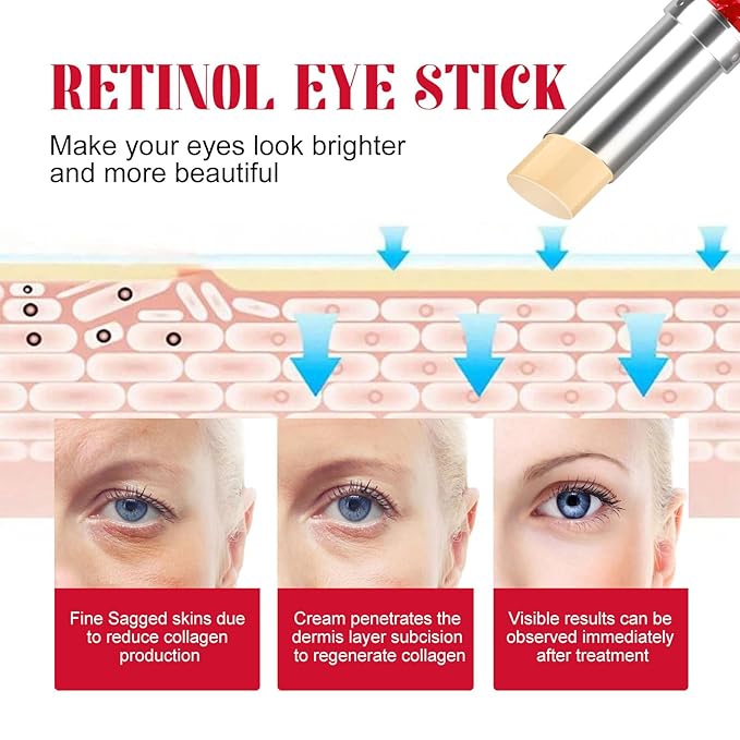Eye Cream, Retinol Eye Stick, Retinol Eye Cream, Retinol Cream, Retinol Face Cream, Under Eye Cream Anti Aging, Moisturizing Eye Balm Reduces Wrinkles Fine Lines and Dark Circles-Velvo Beauty