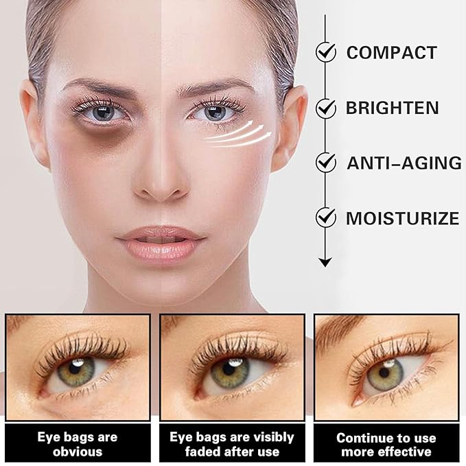 Eye Cream for Dark Circles Bags Eye Cream Eye Products Under Eye Bags Dark Circles-Velvo Beauty