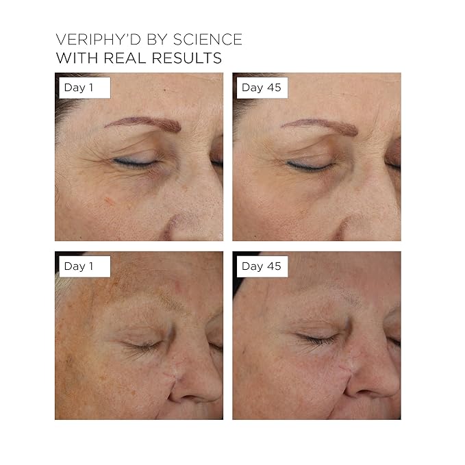 20/20 Eye Cream for Dark Circles and Puffiness | Vegan | Clean | Natural | Cruelty-free | Anti-Aging | Eye Cream for Wrinkles | Women in STEM-Velvo Beauty
