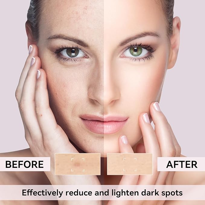 Dark Spot Remover for Face, Dark Spot Corrector for Age Spot Sun Spot Brown Spot Melasma Uneven Skin Tone, with Vitamin C and Hyaluronic Acid for Women and Men, 1.7 FL OZ-Velvo Beauty