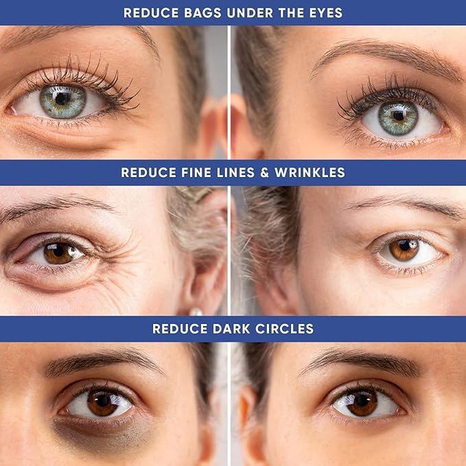 Instant Puffy Eye & Lift Treatment – Removes Under Eye Bags & Puffiness. Eliminate Dark Circles & Wrinkles. Naturally Ageless Hydrating Cream. Disappears Before Your Eyes Within Minutes.-Velvo Beauty