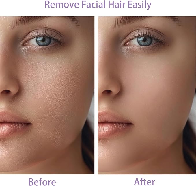 Women Facial Hair Removal Device Battery Operated with 2 Replacement Heads, Painless Womens Face Shaver for Chin Upper Lips Peach Fuzz-Velvo Beauty