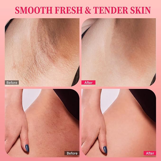 Bikini Area Exfoliator with 10% AHAs BHA & Vitamin C, Exfoliating Body Scrub for Ingrown Hair and Underarm Bumps, Dark Spots, Moisturize Brighten Soothe & Even Skin Tone, Sensitive Skin Safe, 7.76 oz-Velvo Beauty