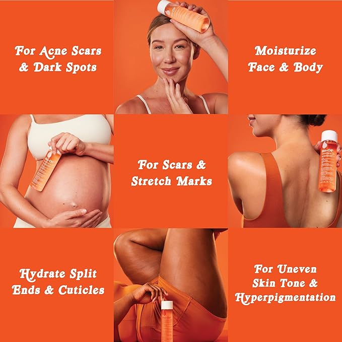 Bio-Oil Skincare Body Oil Serum, Face and Body Moisturizer with Vitamin E & A, for Scars, Stretch Marks, Sensitive Skin, All Skin Types, Dermatologist Recommended, Non-Comedogenic, 2 Oz-Velvo Beauty