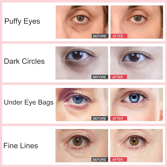 Retinol Eye Stick,Collagen Retinol Eye Cream for Dark Circles and Puffiness, Under Eye Cream Anti Aging, Eye Brightener Stick for Wrinkles Eye Balm Reduces Fine Lines(#1-Retinol Eye Stick)-Velvo Beauty